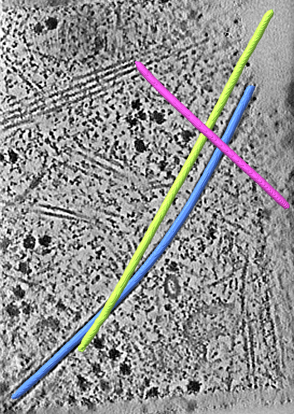 instance segmentation