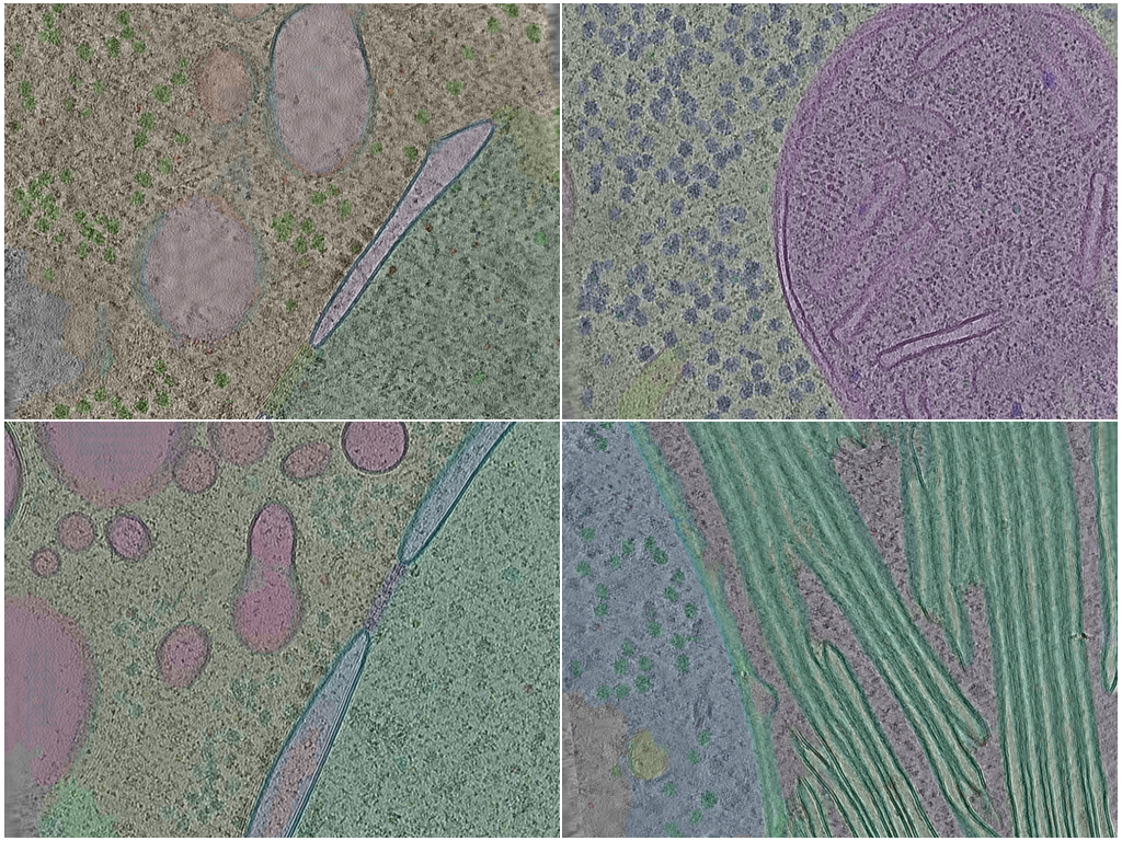 CZ cryoET Data Portal